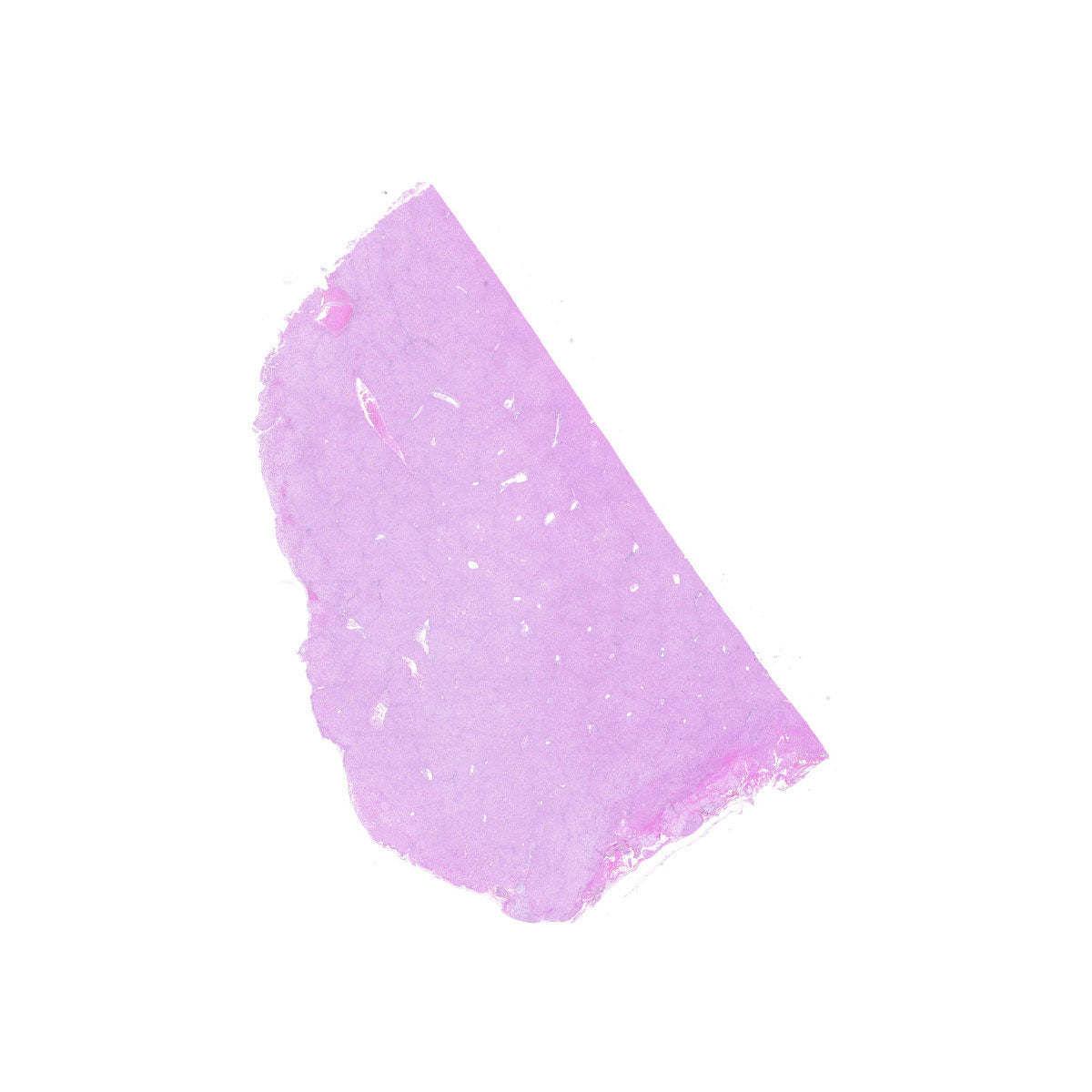Human FFPE NAT Liver Tissue HuN-14-0090