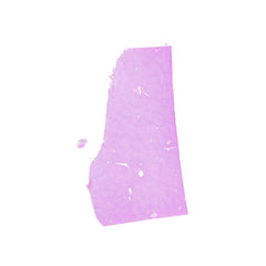 Human FFPE NAT Liver Tissue HuN-14-0091