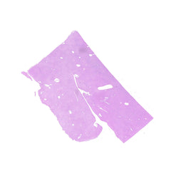 Human FFPE NAT Liver Tissue HuN-14-0092A