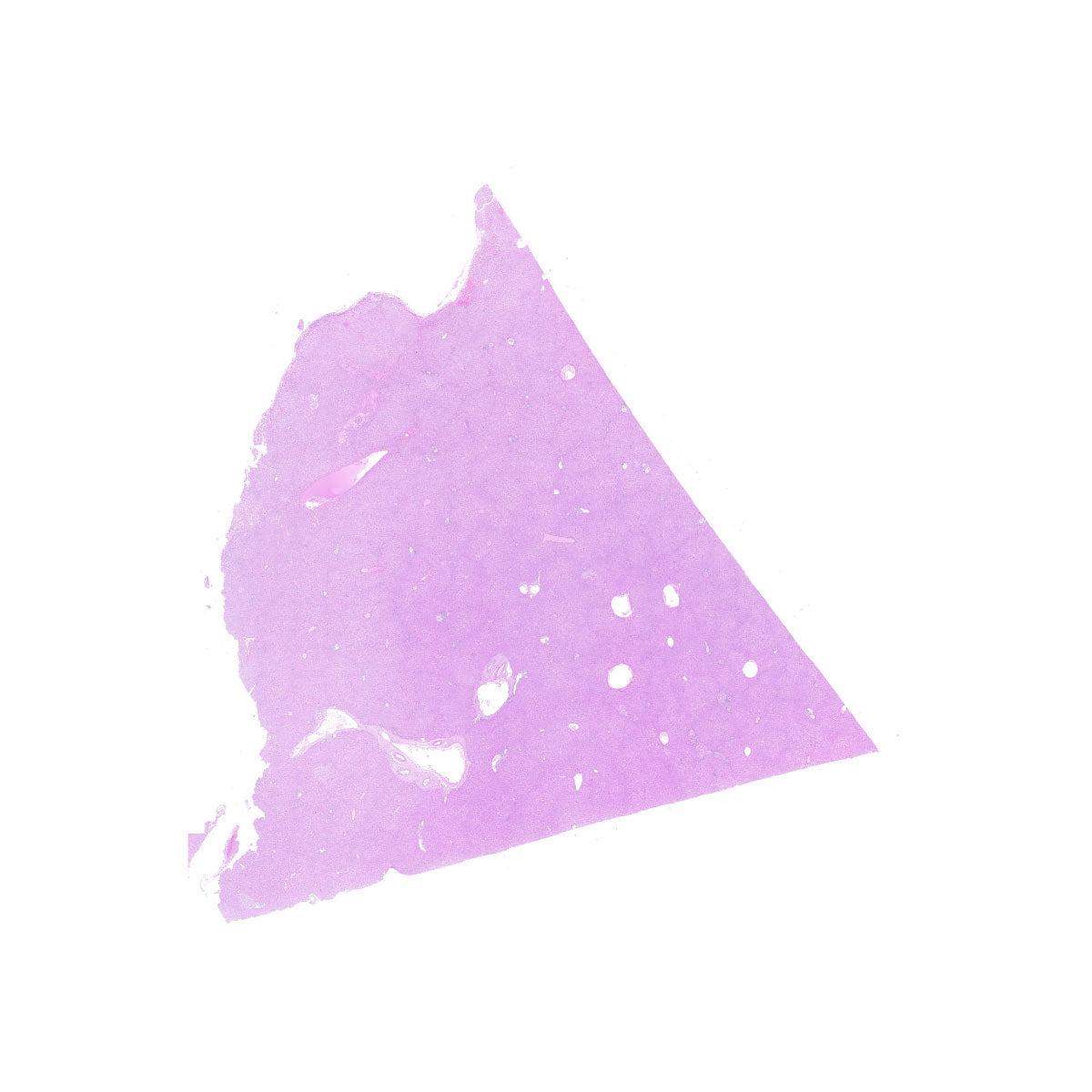 Human FFPE NAT Liver Tissue HuN-14-0093