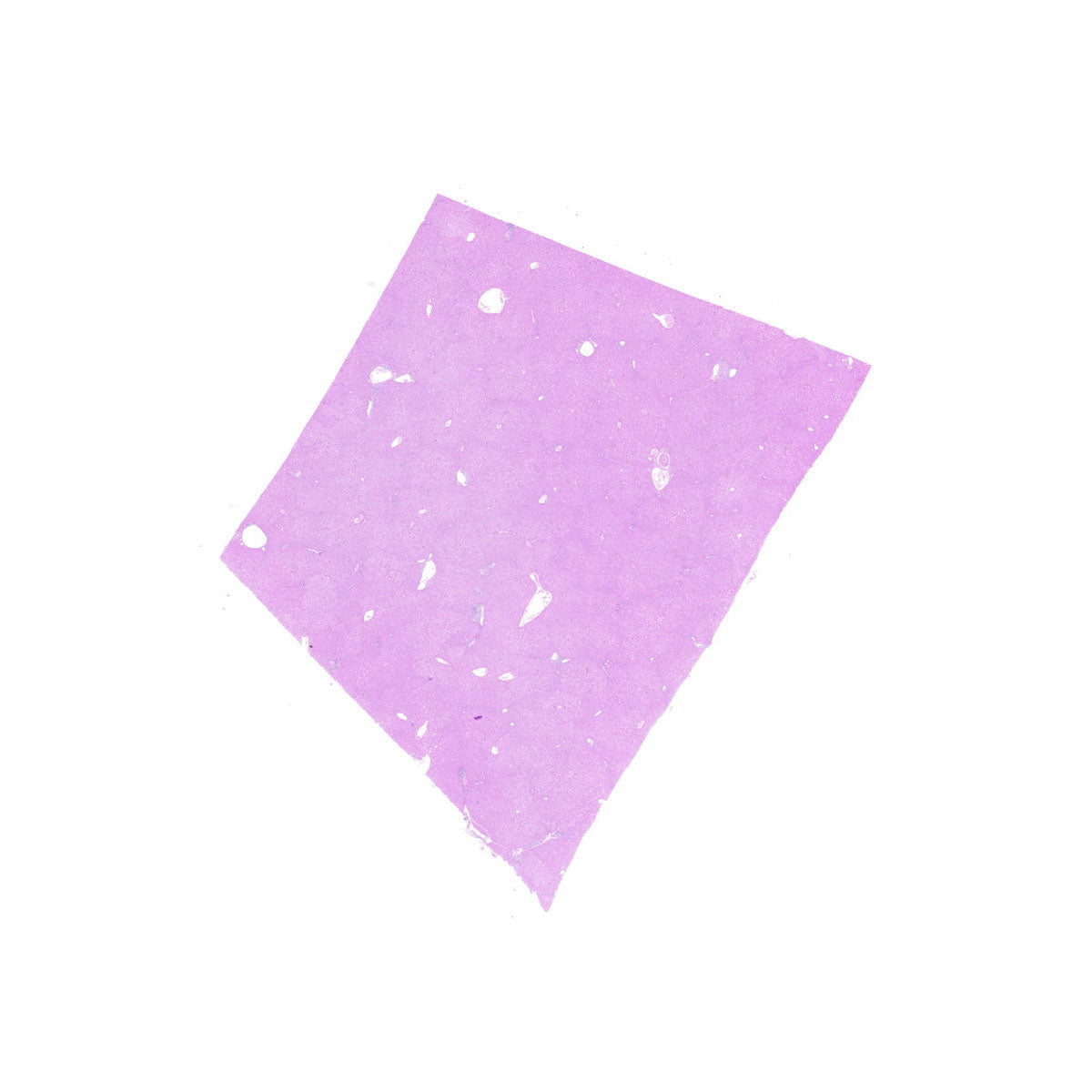 Human FFPE NAT Liver Tissue HuN-14-0094A