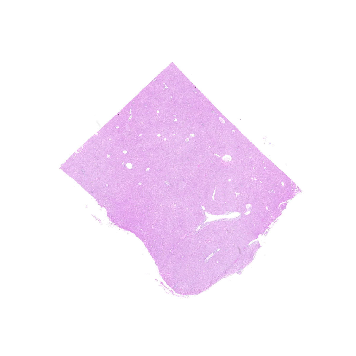 Human FFPE NAT Liver Tissue HuN-14-0094B