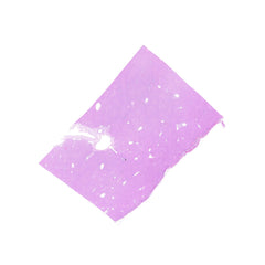 Human FFPE NAT Liver Tissue HuN-14-0095A