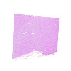 Human FFPE NAT Liver Tissue HuN-14-0096B
