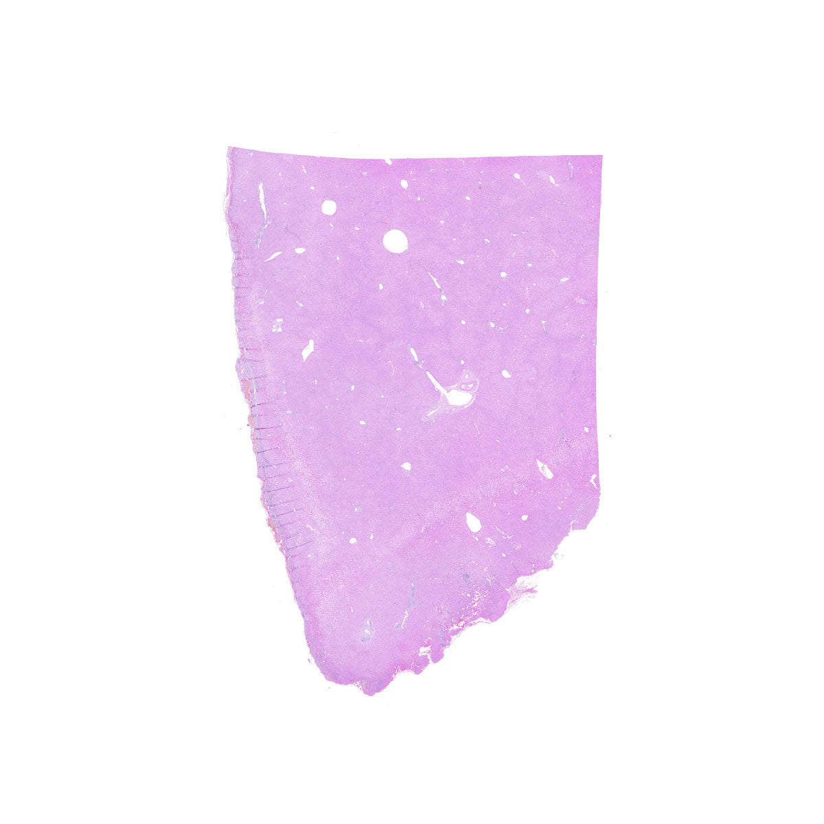 Human FFPE NAT Liver Tissue HuN-14-0097