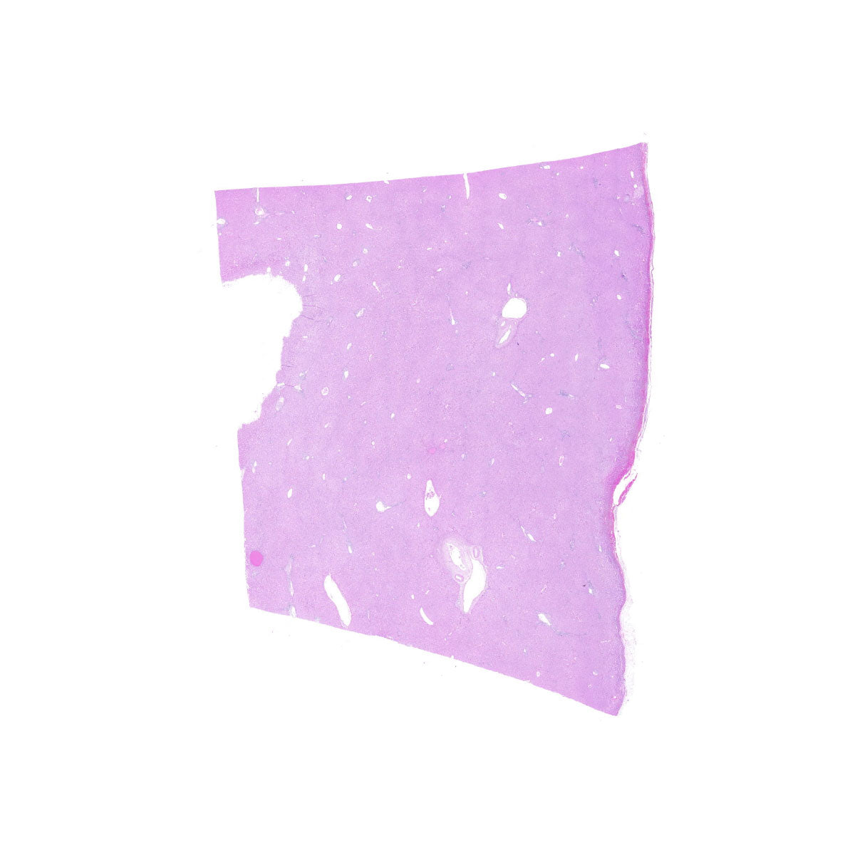 Human FFPE NAT Liver Tissue HuN-14-0098
