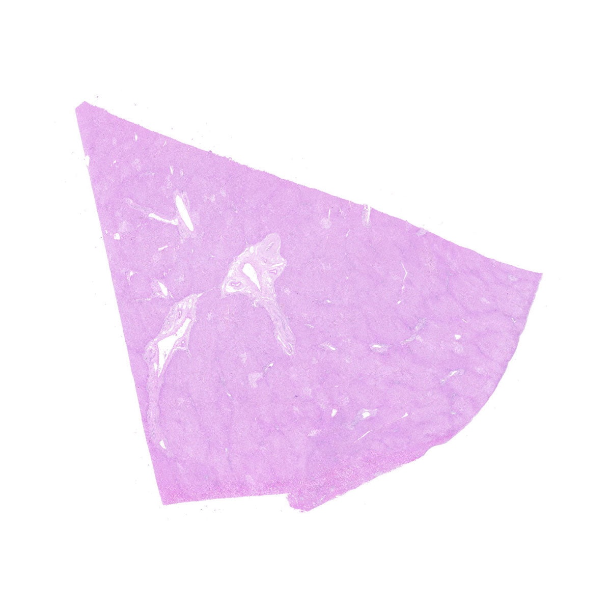 Human FFPE NAT Liver Tissue HuN-14-0100A