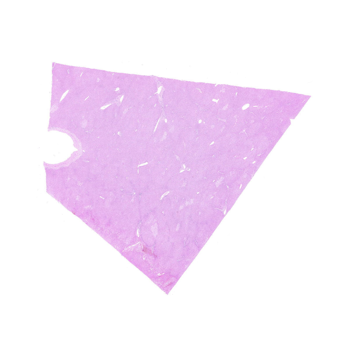 Human FFPE NAT Liver Tissue HuN-14-0100B