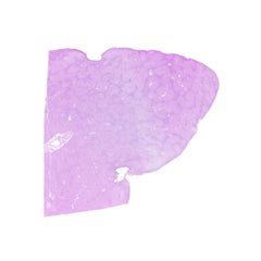 Human FFPE NAT Liver Tissue HuN-14-0101