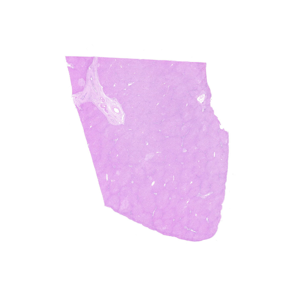 Human FFPE NAT Liver Tissue HuN-14-0102
