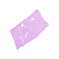 Human FFPE NAT Liver Tissue HuN-14-0103A