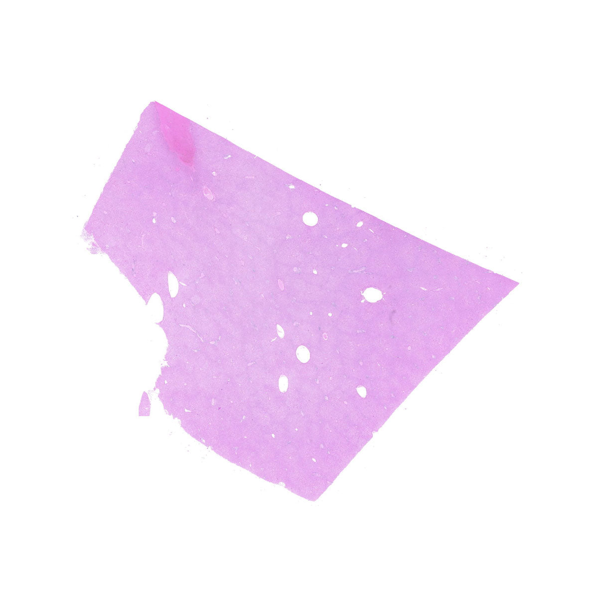 Human FFPE NAT Liver Tissue HuN-14-0103B