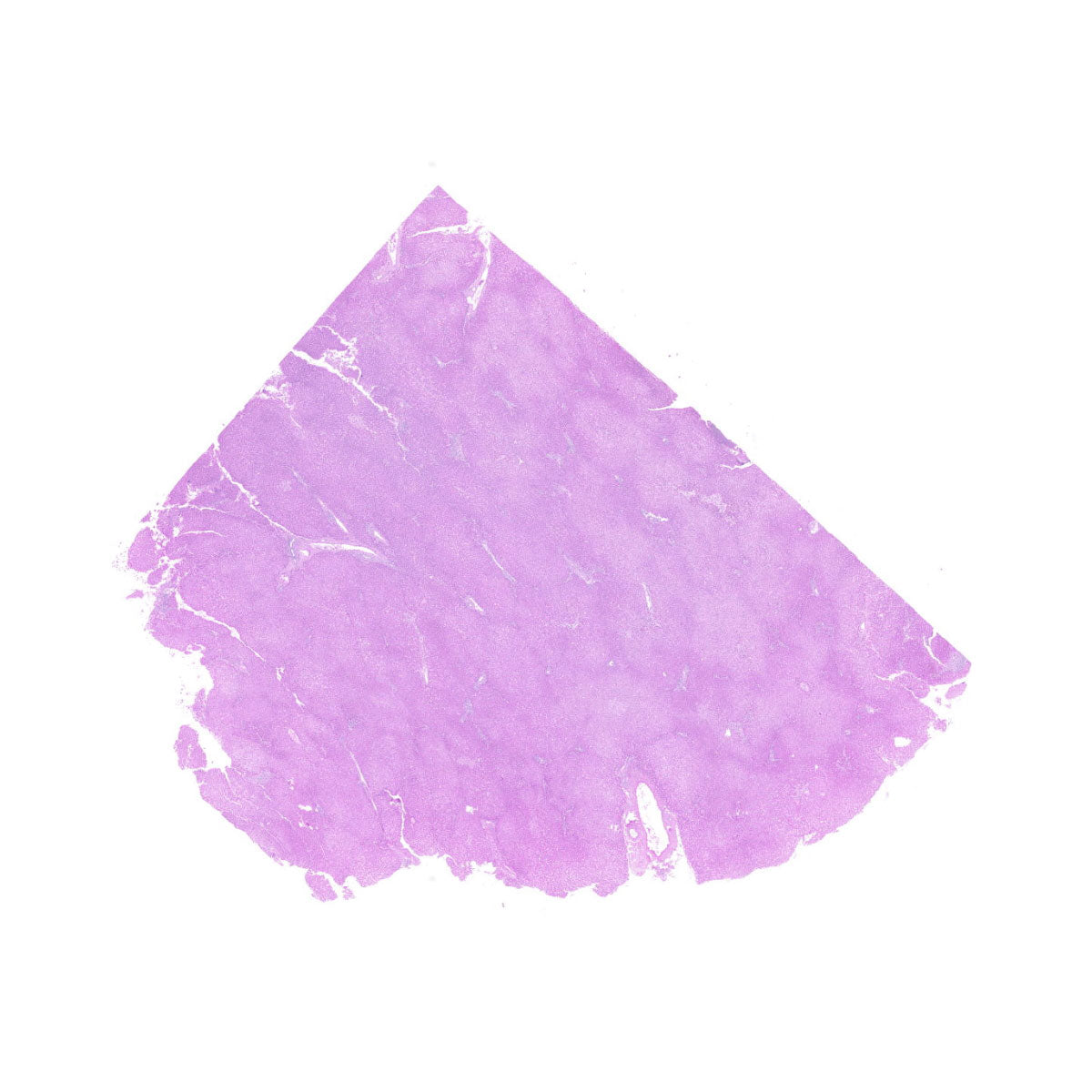 Human FFPE NAT Liver Tissue HuN-14-0106A