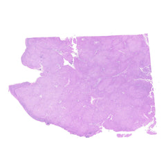 Human FFPE NAT Liver Tissue HuN-14-0106B