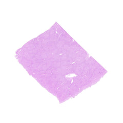 Human FFPE NAT Liver Tissue HuN-14-0107A