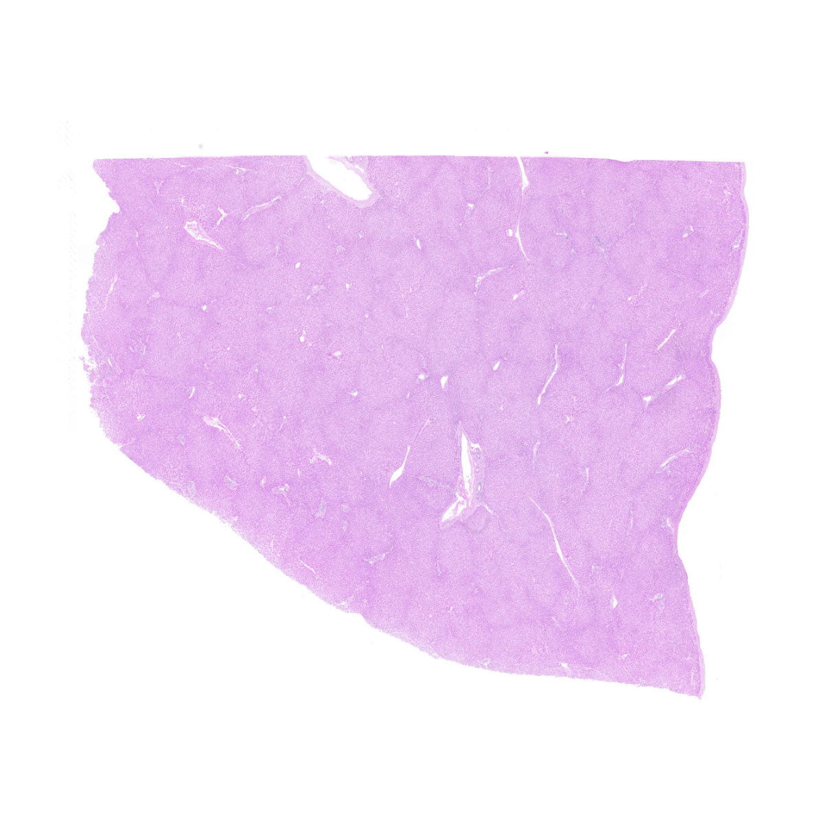 Human FFPE NAT Liver Tissue HuN-14-0107B
