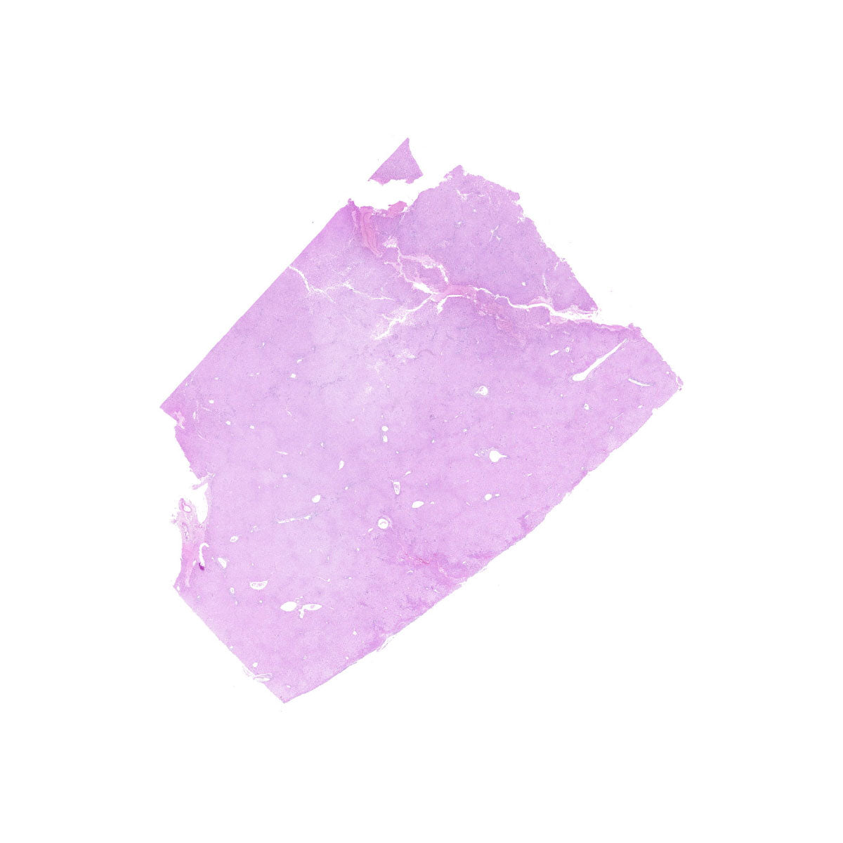 Human FFPE NAT Liver Tissue HuN-14-0109A