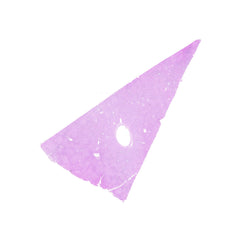Human FFPE NAT Liver Tissue HuN-14-0110A