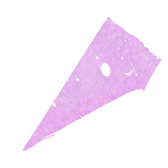 Human FFPE NAT Liver Tissue HuN-14-0110B
