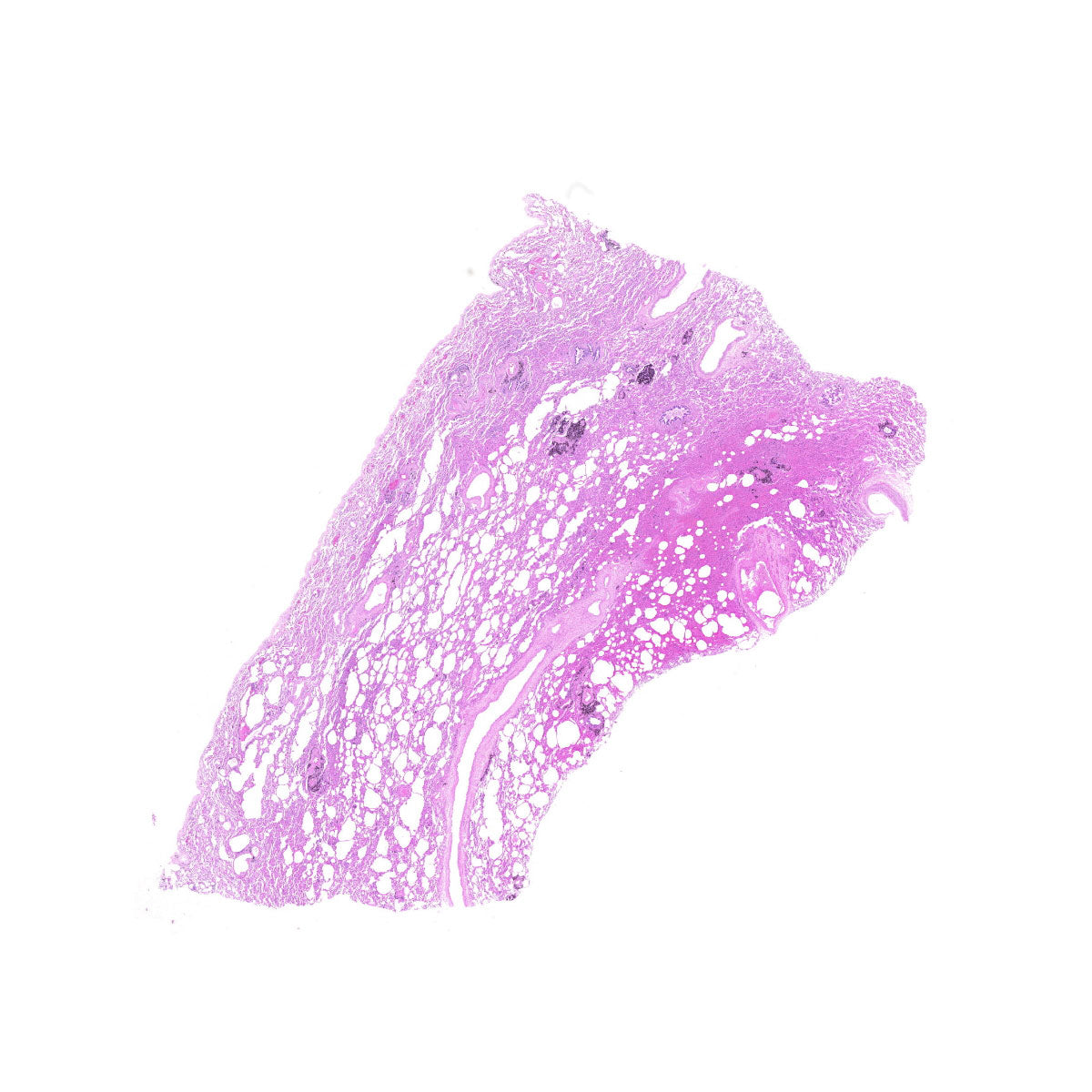 Human FFPE NAT Lung Tissue HuN-15-0057
