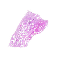 Human FFPE NAT Lung Tissue HuN-15-0057