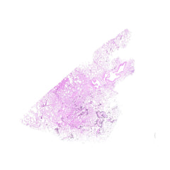 Human FFPE NAT Lung Tissue HuN-15-0061A