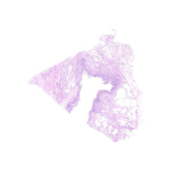 Human FFPE NAT Lung Tissue HuN-15-0063A