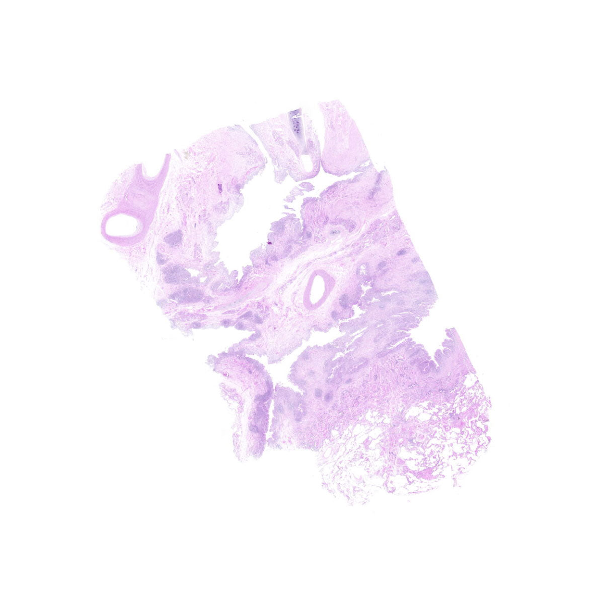 Human FFPE NAT Lung Tissue HuN-15-0063B