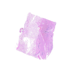 Human FFPE NAT Lung Tissue HuN-15-0064
