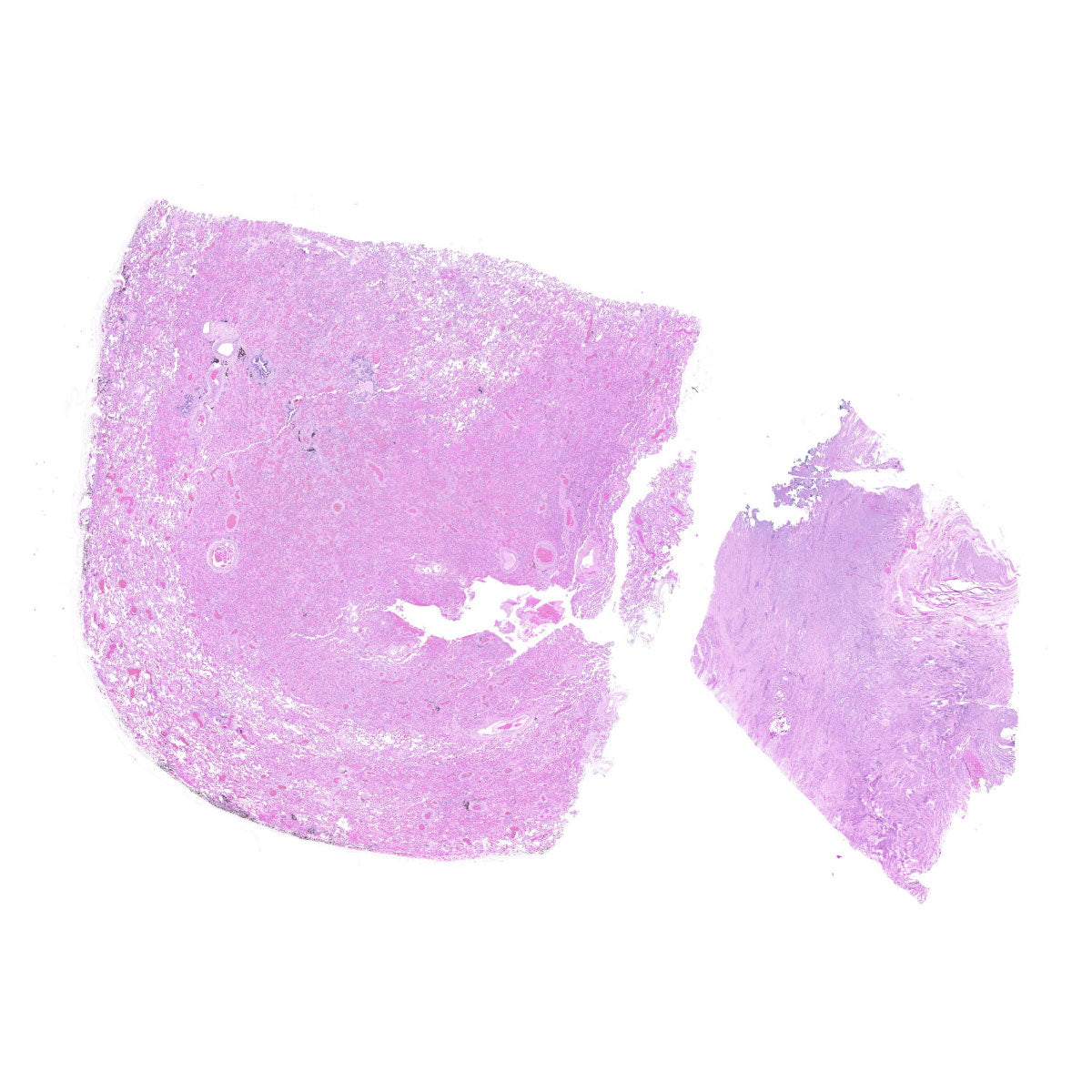 Human FFPE NAT Lung Tissue HuN-15-0068
