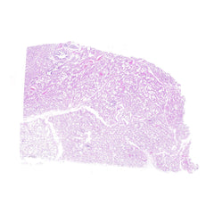 Human FFPE NAT Lung Tissue HuN-15-0075
