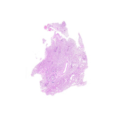 Human FFPE NAT Lung Tissue HuN-15-0080