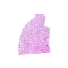 Human FFPE NAT Lung Tissue HuN-15-0081
