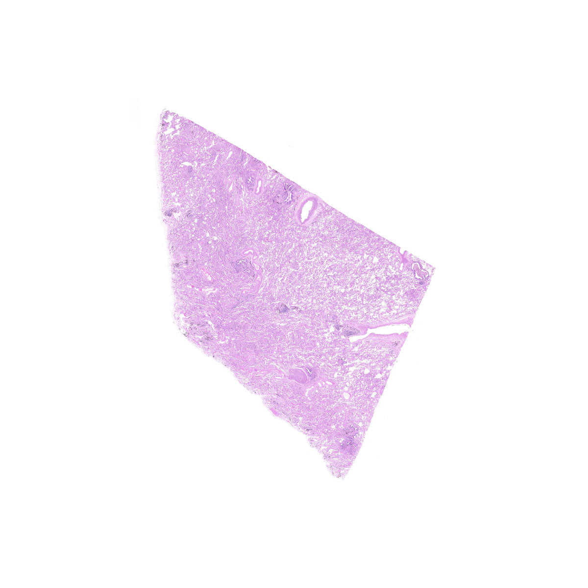 Human FFPE NAT Lung Tissue HuN-15-0083A