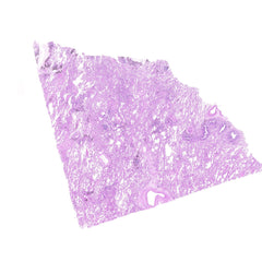 Human FFPE NAT Lung Tissue HuN-15-0085B