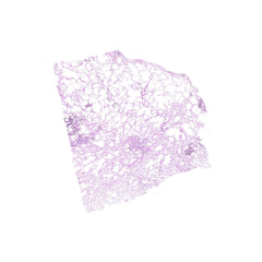 Human FFPE NAT Lung Tissue HuN-15-0088B