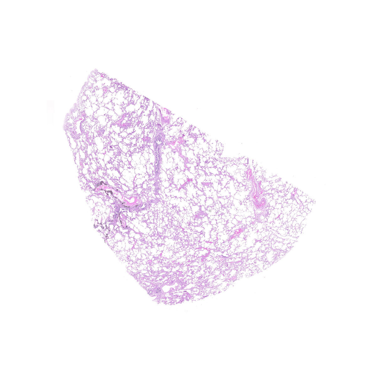 Human FFPE NAT Lung Tissue HuN-15-0089B