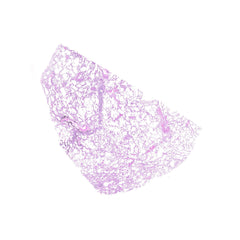 Human FFPE NAT Lung Tissue HuN-15-0089B