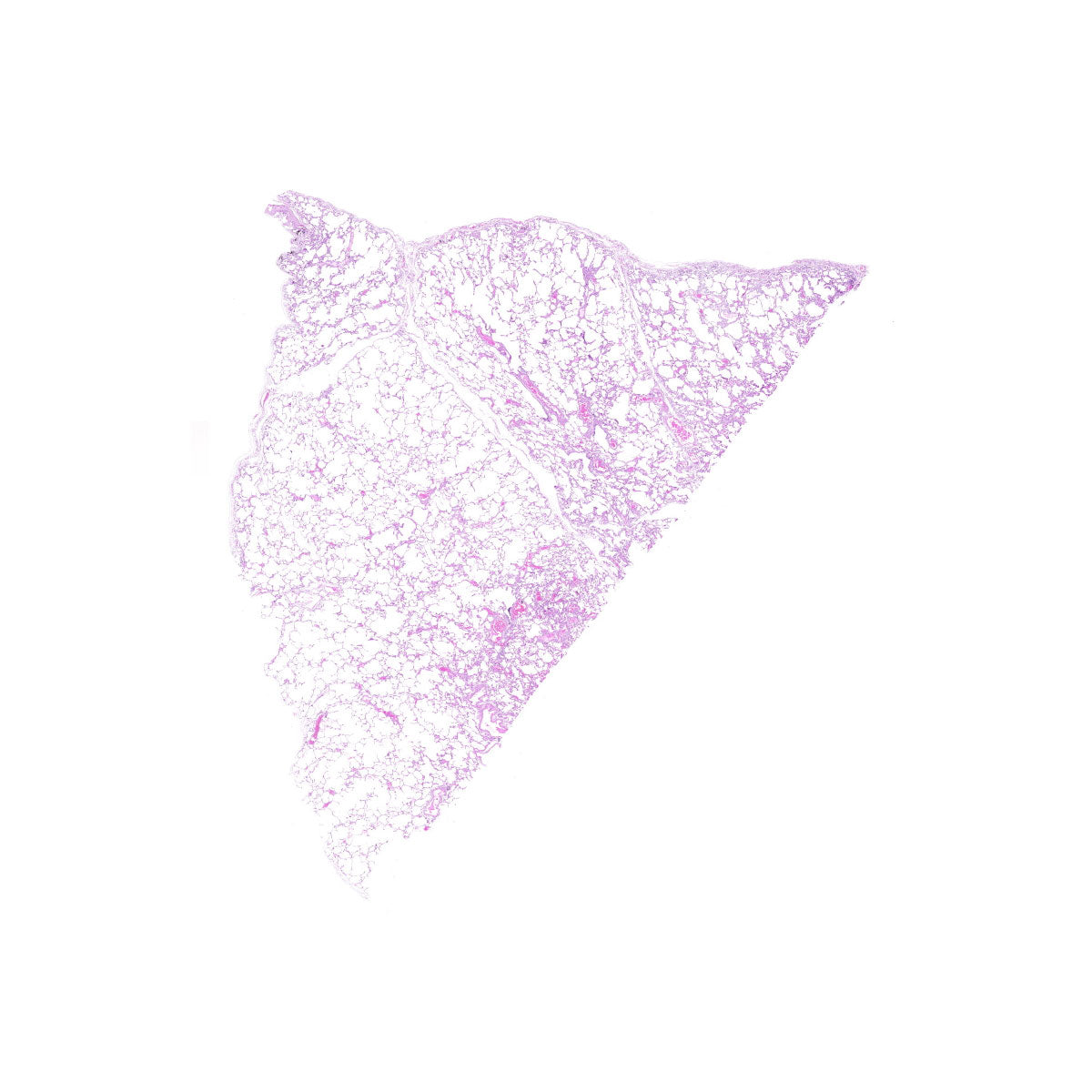 Human FFPE NAT Lung Tissue HuN-15-0090B
