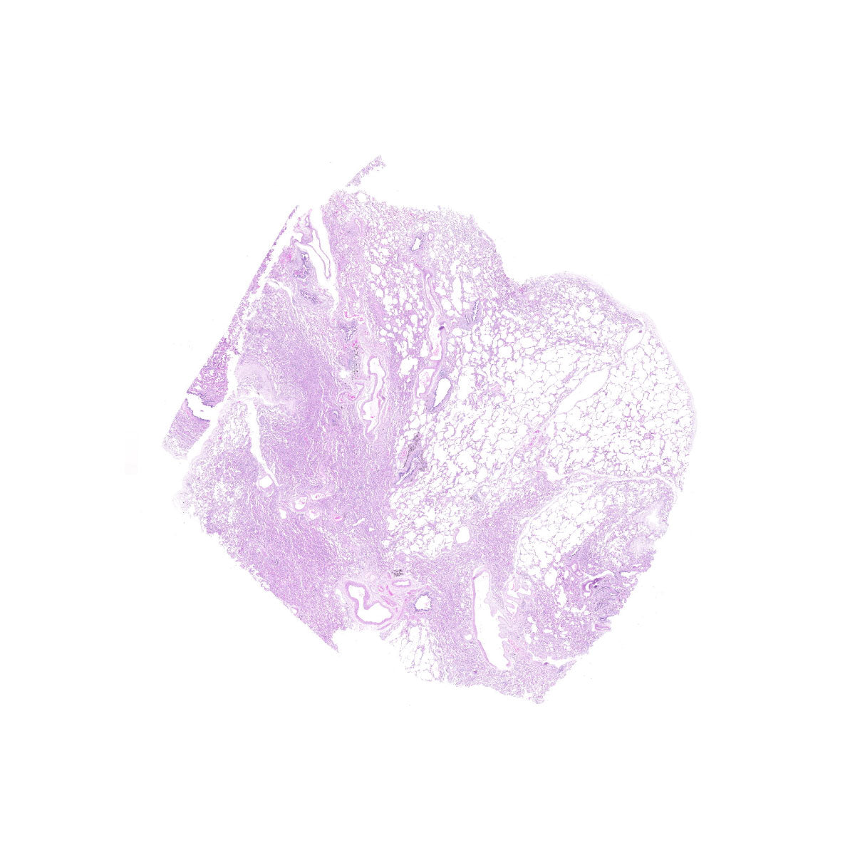 Human FFPE NAT Lung Tissue HuN-15-0091