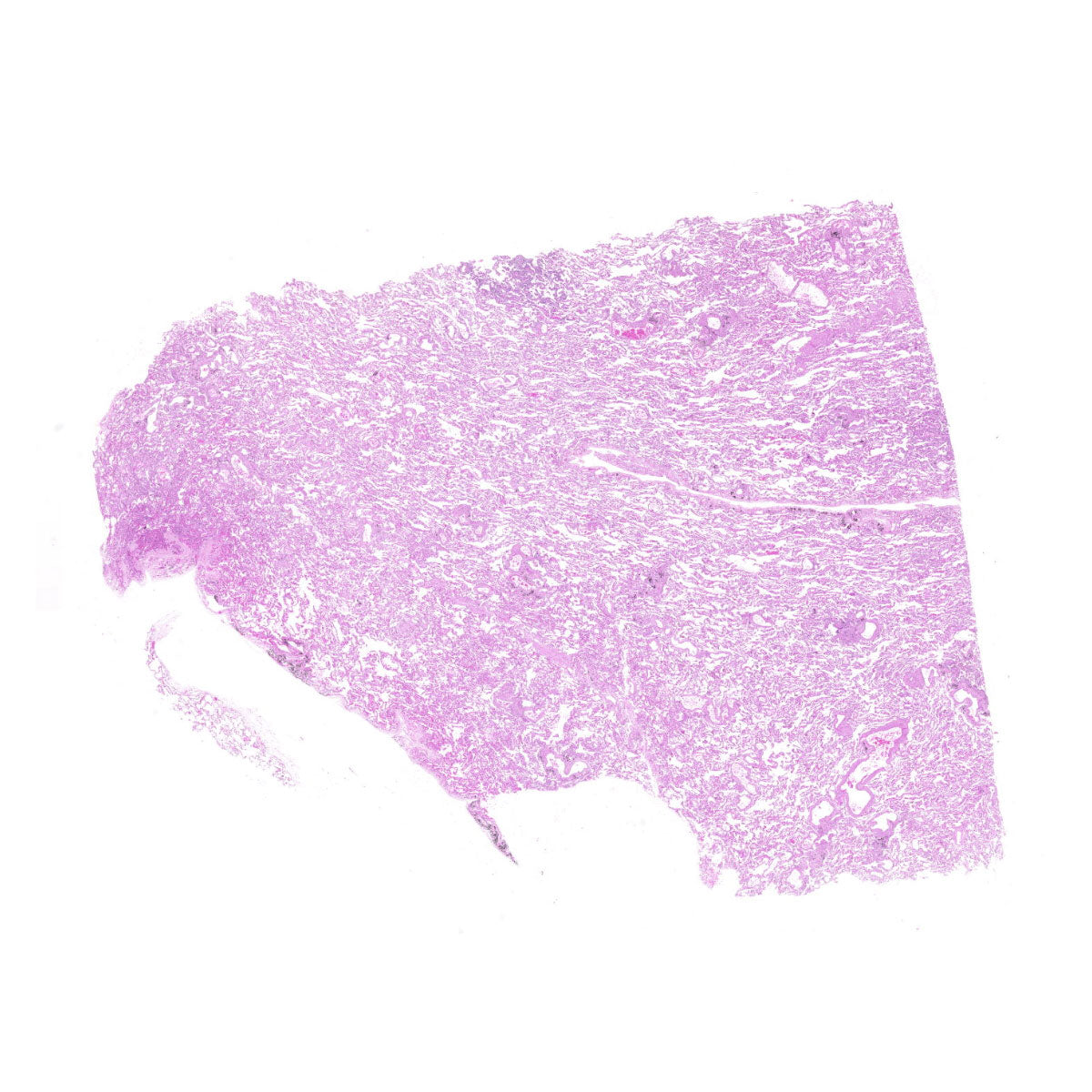 Human FFPE NAT Lung Tissue HuN-15-0094