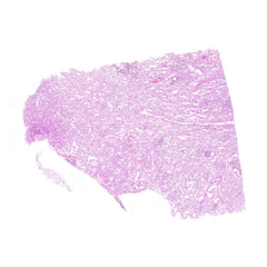 Human FFPE NAT Lung Tissue HuN-15-0094