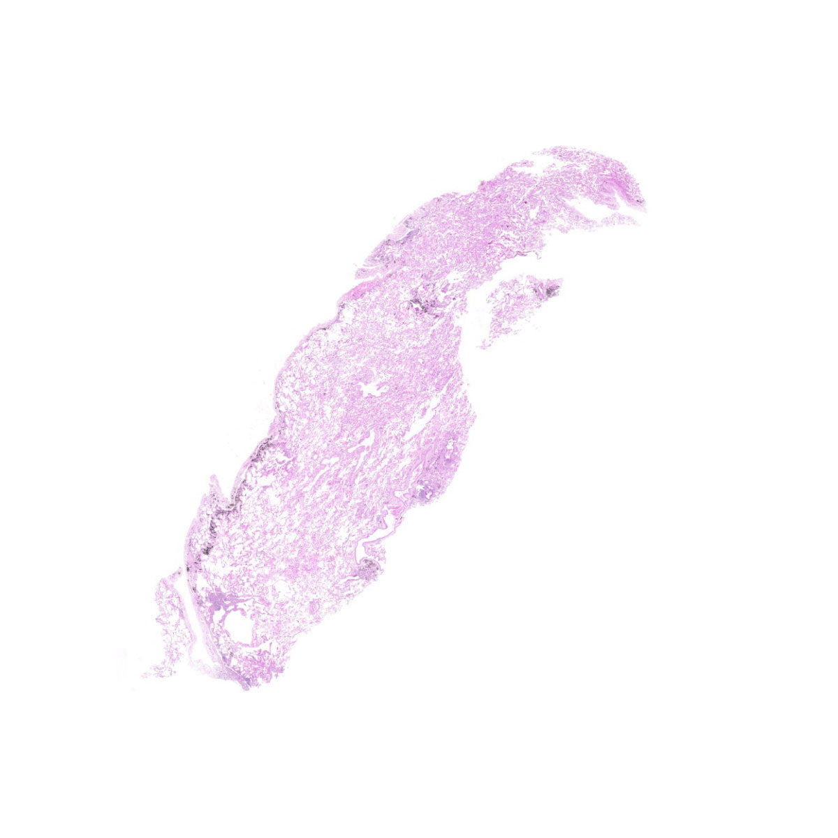 Human FFPE NAT Lung Tissue HuN-15-0095