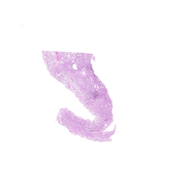 Human FFPE NAT Lung Tissue HuN-15-0096A