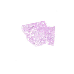 Human FFPE NAT Lung Tissue HuN-15-0096B
