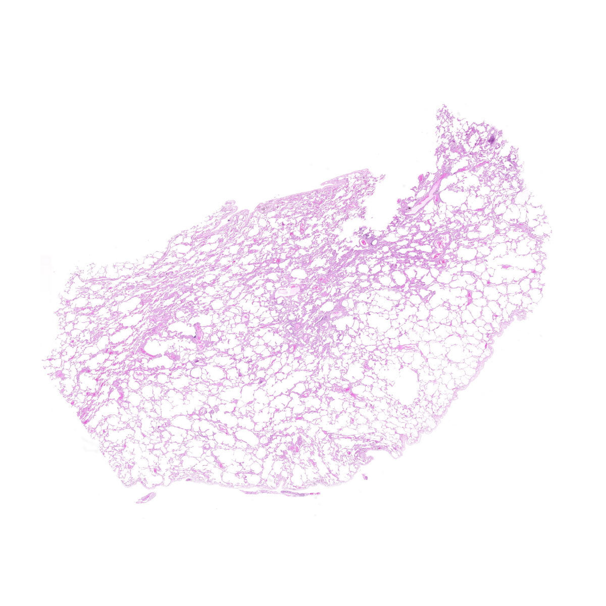 Human FFPE NAT Lung Tissue HuN-15-0097