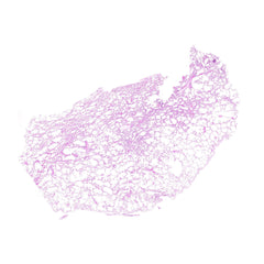 Human FFPE NAT Lung Tissue HuN-15-0097