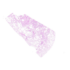 Human FFPE NAT Lung Tissue HuN-15-0098A