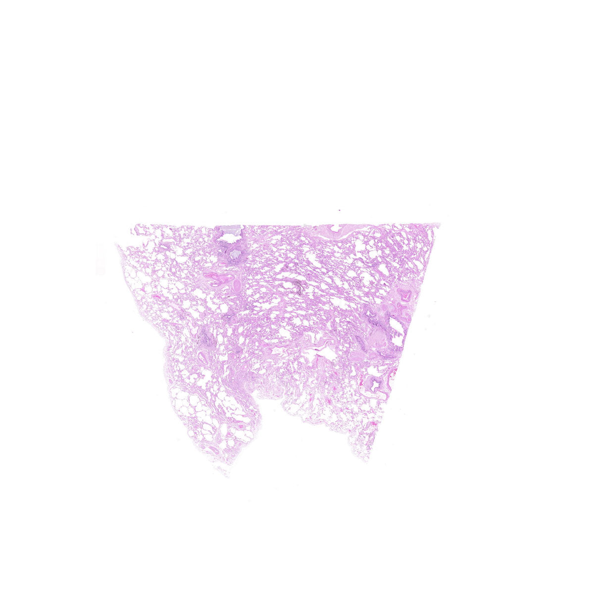 Human FFPE NAT Lung Tissue HuN-15-0098B