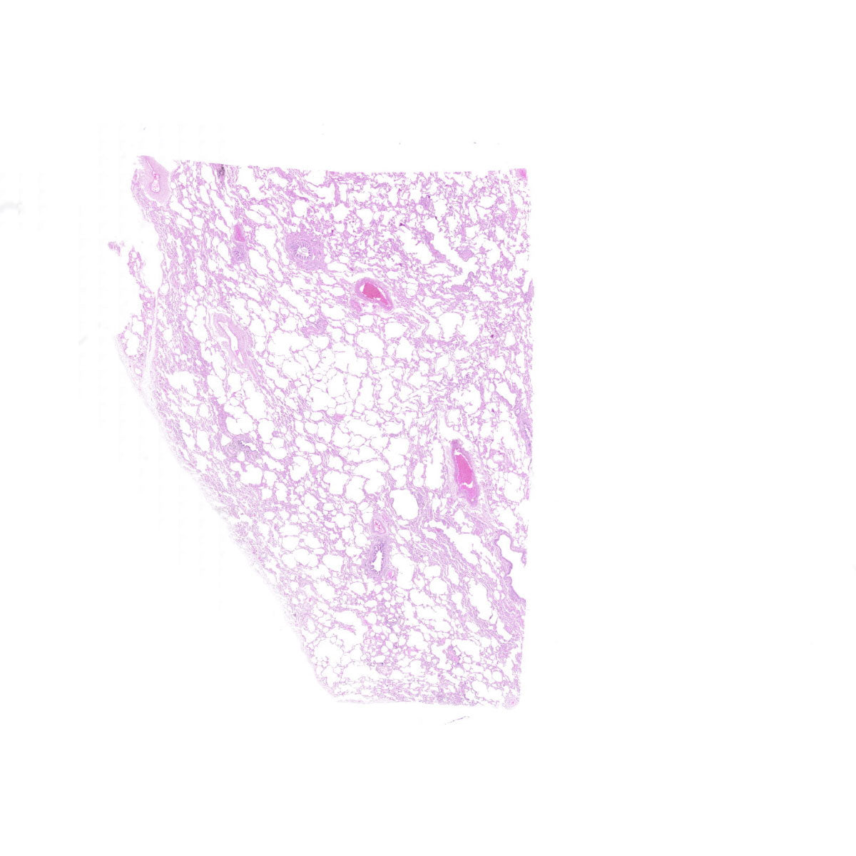 Human FFPE NAT Lung Tissue HuN-15-0099A